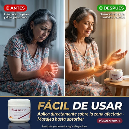 ARTIFLEX crema para dolor articulaciones - SurtiShop